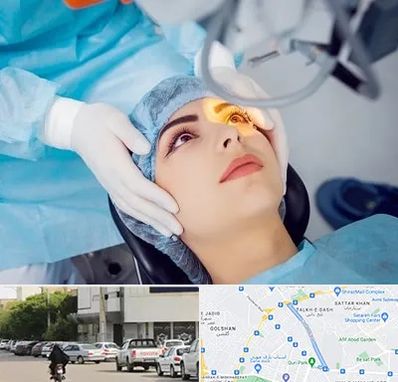 دکتر عمل لیزیک چشم در قدوسی شرقی شیراز