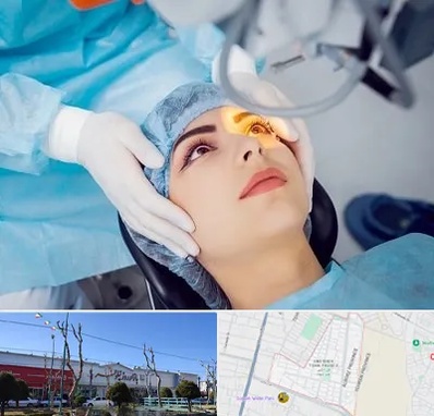 دکتر عمل لیزیک چشم در فاز دو اندیشه