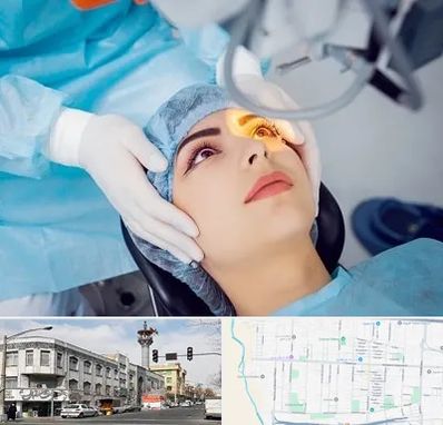 دکتر عمل لیزیک چشم در 17شهریور