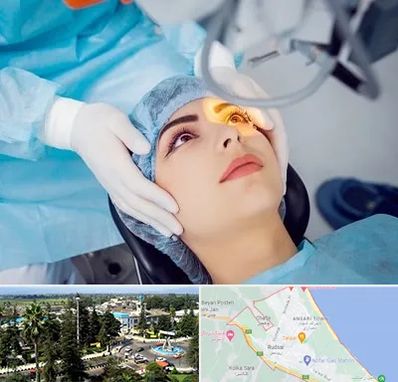 دکتر عمل لیزیک چشم در رودسر