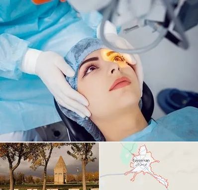 دکتر عمل لیزیک چشم در تویسرکان
