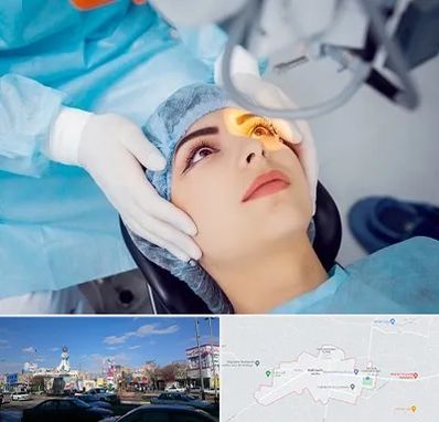 دکتر عمل لیزیک چشم در ماهدشت کرج