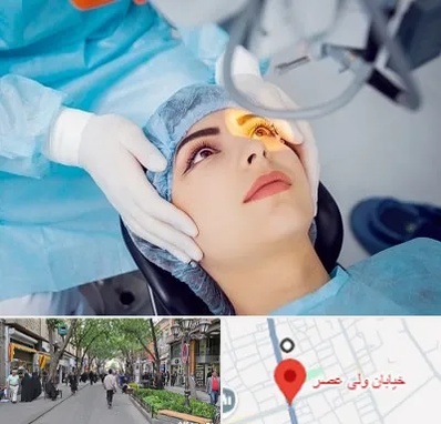 دکتر عمل لیزیک چشم در ولیعصر شهریار