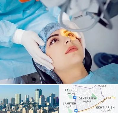دکتر عمل لیزیک چشم در قیطریه