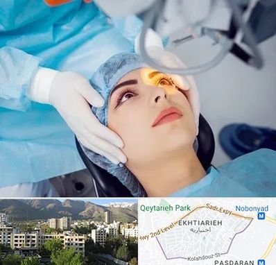 دکتر عمل لیزیک چشم در اختیاریه