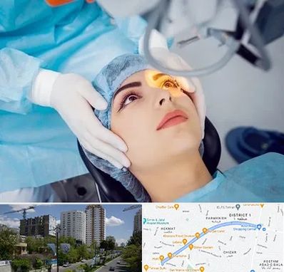 دکتر عمل لیزیک چشم در اندرزگو