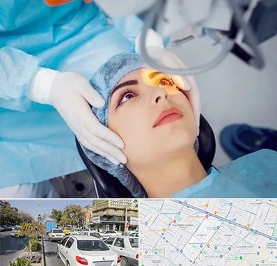 دکتر عمل لیزیک چشم در مفتح مشهد