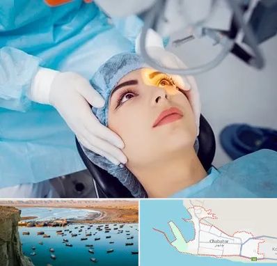 دکتر عمل لیزیک چشم در چابهار
