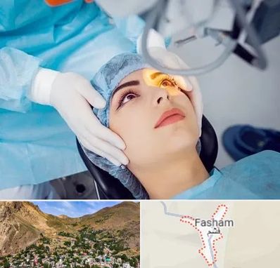 دکتر عمل لیزیک چشم در فشم