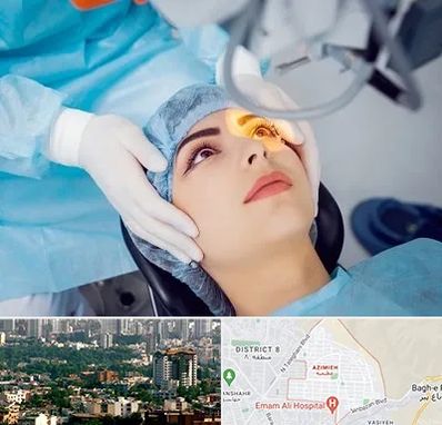 دکتر عمل لیزیک چشم در عظیمیه کرج