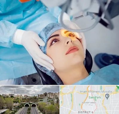 دکتر عمل لیزیک چشم در یوسف آباد