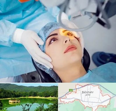 دکتر عمل لیزیک چشم در بهشهر