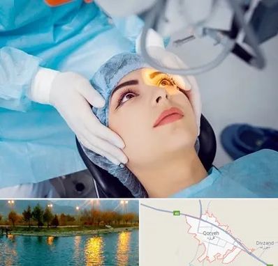 دکتر عمل لیزیک چشم در قروه