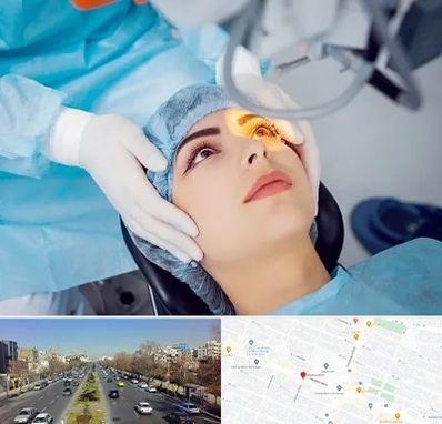دکتر عمل لیزیک چشم در بلوار معلم مشهد