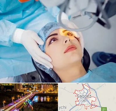 دکتر عمل لیزیک چشم در سقز