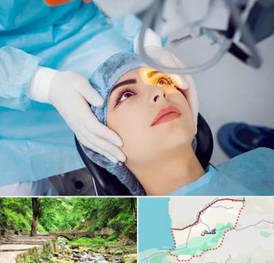 دکتر عمل لیزیک چشم در گلستان