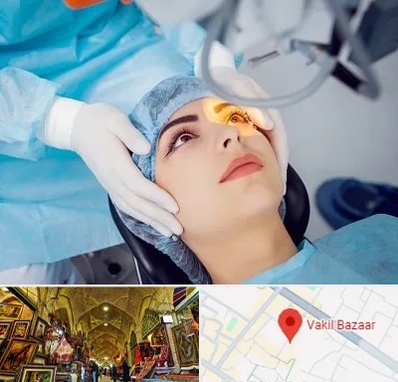 دکتر عمل لیزیک چشم در بازار وکیل شیراز