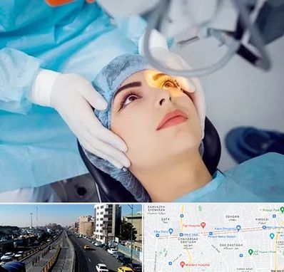 دکتر عمل لیزیک چشم در پیروزی