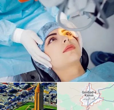 دکتر عمل لیزیک چشم در گنبد کاووس