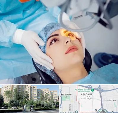 دکتر عمل لیزیک چشم در آپادانا