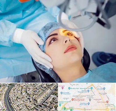 دکتر عمل لیزیک چشم در شهرک غرب مشهد