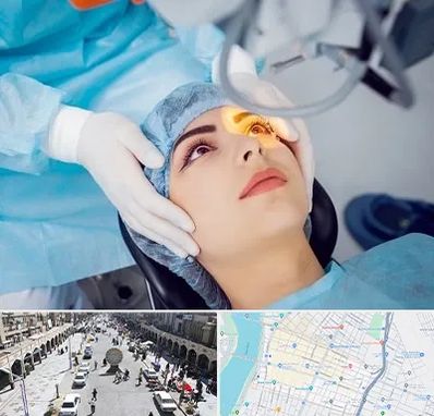 دکتر عمل لیزیک چشم در نادری اهواز