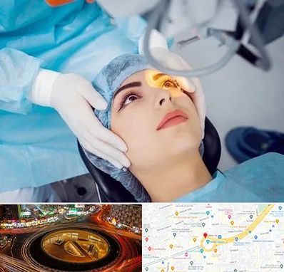 دکتر عمل لیزیک چشم در میدان ولیعصر
