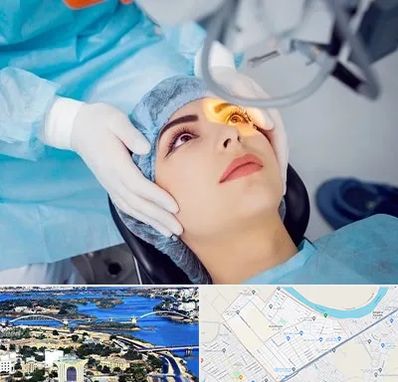 دکتر عمل لیزیک چشم در کوروش اهواز