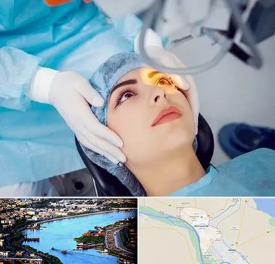 دکتر عمل لیزیک چشم در خرمشهر