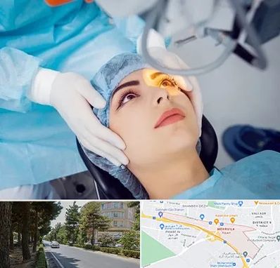 دکتر عمل لیزیک چشم در مهرویلا کرج