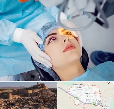 دکتر عمل لیزیک چشم در بم