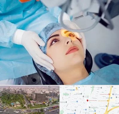 دکتر عمل لیزیک چشم در آیت الله کاشانی