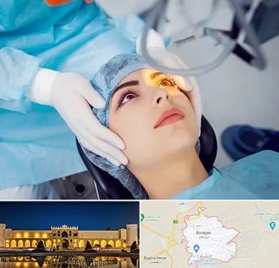 دکتر عمل لیزیک چشم در برازجان