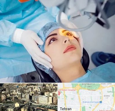 دکتر عمل لیزیک چشم در مرزداران
