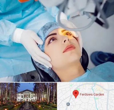 دکتر عمل لیزیک چشم در باغ فردوس