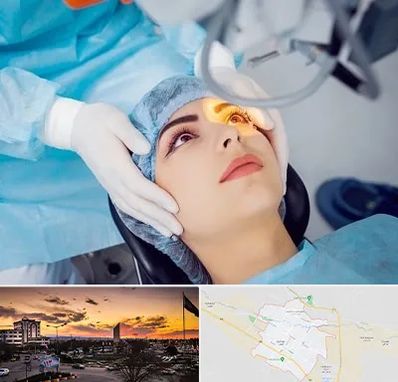 دکتر عمل لیزیک چشم در قوچان
