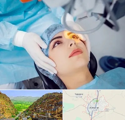 دکتر عمل لیزیک چشم در کامیاران