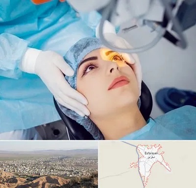 دکتر عمل لیزیک چشم در اسفراین