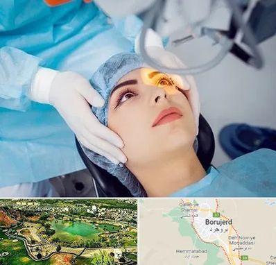 دکتر عمل لیزیک چشم در بروجرد