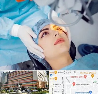 دکتر عمل لیزیک چشم در سهروردی