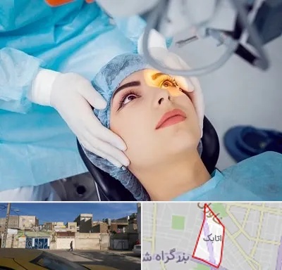 دکتر عمل لیزیک چشم در اتابک