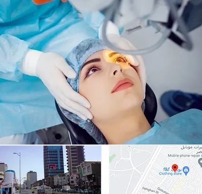 دکتر عمل لیزیک چشم در چهارراه طالقانی کرج