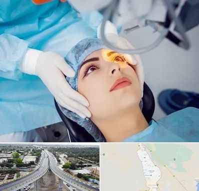 دکتر عمل لیزیک چشم در اندیمشک