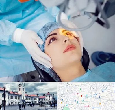 دکتر عمل لیزیک چشم در میدان شهرداری رشت