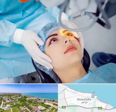 دکتر عمل لیزیک چشم در نوشهر