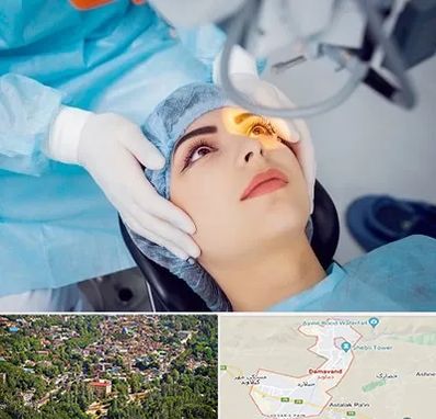 دکتر عمل لیزیک چشم در دماوند