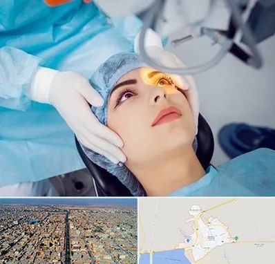 دکتر عمل لیزیک چشم در بندر ماهشهر