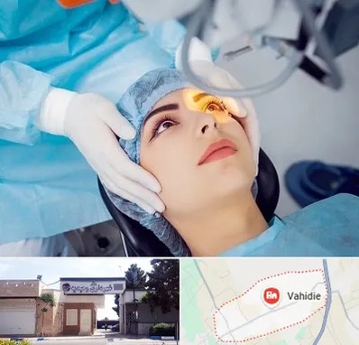 دکتر عمل لیزیک چشم در وحیدیه شهریار