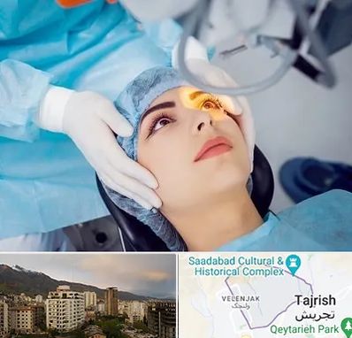 دکتر عمل لیزیک چشم در زعفرانیه