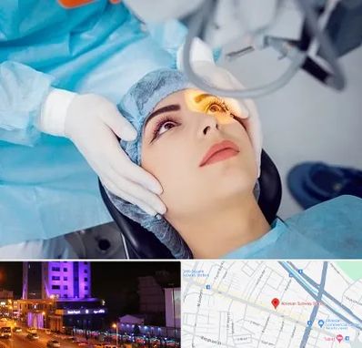 دکتر عمل لیزیک چشم در آبرسان تبریز